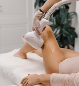Laser Hair Removal